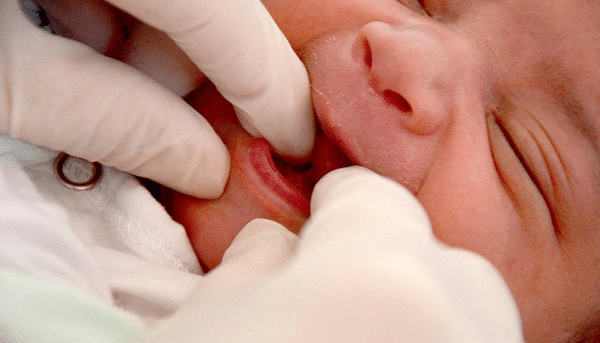 Os 6 testes obrigatórios para o recém-nascido e para que servem