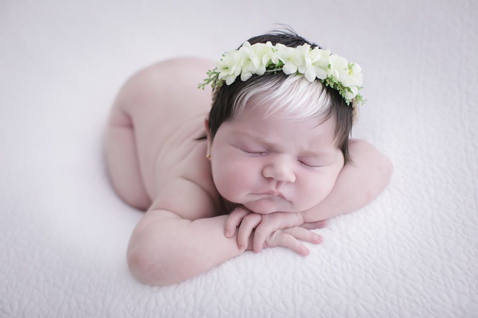 Bebê nasce com mexa de cabelo branca e encanta com tamanha beleza