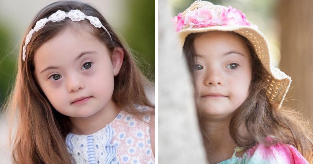 Menina de 4 anos com síndrome de Down fotografa pra Gucci. Ser diferente é de onde vem sua beleza