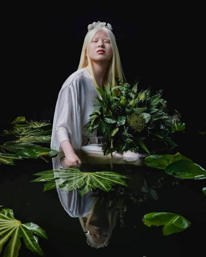 pais24hs.com - Abandonada ainda bebê por ter albinismo, chinesa vira modelo e brilha na Vogue Itália